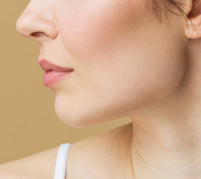 After image for Acne