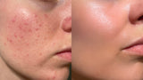 Preview for Inflammation