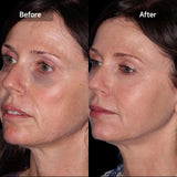 Preview for Dark Circles