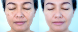 Preview for Pigmentation