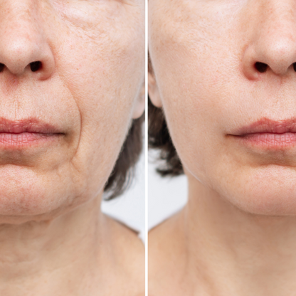 Lumina Red™ LED Face & Neck Mask ElderonPlus