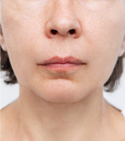 After image for Wrinkles