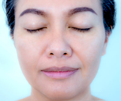 After image for Pigmentation